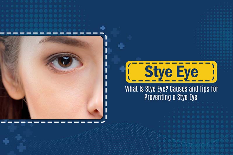 Stye-eye